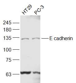 bs-10009R，bioss，上皮钙粘附分子抗体 E cadherin